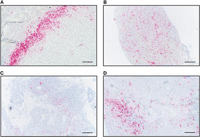 Macrophages/Microglia Represent the Major Source of Indolamine 2,3-Dioxygenase Expression in Melanoma Metastases of the Brain